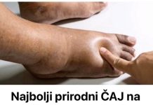 Najbolji Prirodni ČAJ Na Svijetu Za Uklanjanje 0TEKLINA!