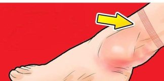 5 pokazatelja da nešto nije u redu s vašim SRCEM: Nastavite s IZNIMNIM oprezom!