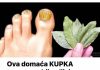 Ova domaća KUPKA trenutno ubija gljivice na noktima: Pomoći će čak i u najgorim slučajevima!