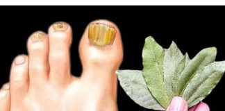 Ova domaća KUPKA trenutno ubija gljivice na noktima: Pomoći će čak i u najgorim slučajevima!