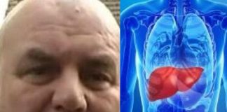 Znaci bolesti koja je dovela do smrti Dragana Markovića Palme.