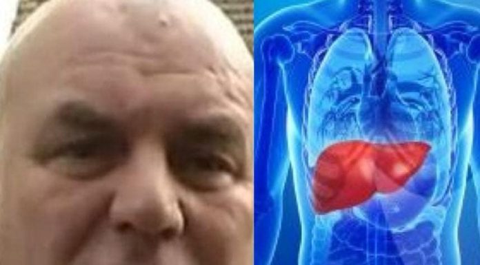 Znaci bolesti koja je dovela do smrti Dragana Markovića Palme.