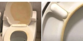 Kako ukloniti žute mrlje s WC školjke?