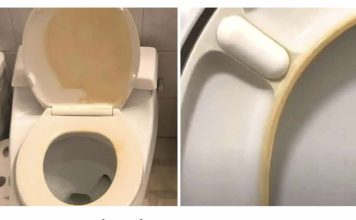 Kako ukloniti žute mrlje s WC školjke?