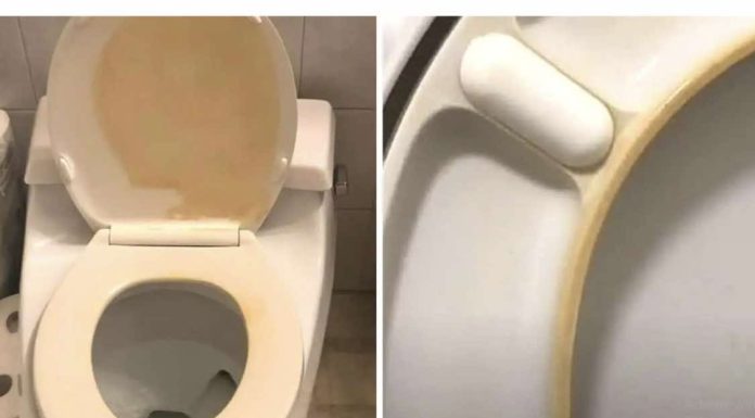 Kako ukloniti žute mrlje s WC školjke?