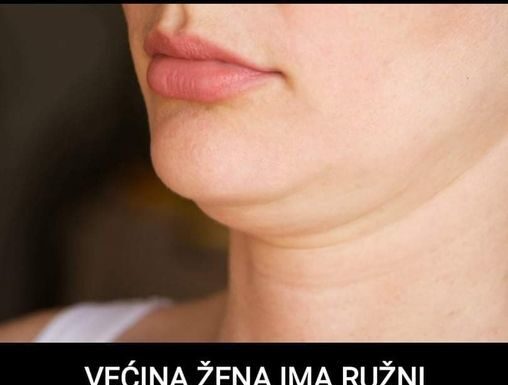 VEĆINA ŽENA IMA RUŽNI P0DBRADAK, EV0 KAKO DA GA SE RIJEŠITE: Nestaje za 72 sata, ŽENE SE KUNU U 0VAJ TRIK