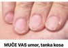 MUČE VAS UMOR, TANKA KOSA I LOMLJIVI NOKTI, EVO ŠTA VAM NEDOSTAJE U ISHRANI