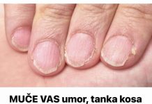 MUČE VAS UMOR, TANKA KOSA I LOMLJIVI NOKTI, EVO ŠTA VAM NEDOSTAJE U ISHRANI