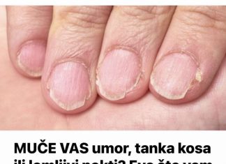 MUČE VAS UMOR, TANKA KOSA I LOMLJIVI NOKTI, EVO ŠTA VAM NEDOSTAJE U ISHRANI