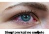 Simptom koji ne smijete zanemariti: Popucale vene u oku mogu biti PRVI ZNAK ozbiljne bolesti.