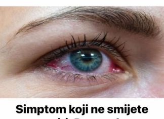 Simptom koji ne smijete zanemariti: Popucale vene u oku mogu biti PRVI ZNAK ozbiljne bolesti.