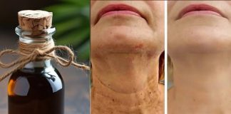 Čarobno ulje protiv starenja, ☘️ Zaglađuje sve bore na licu snažnije od botoksa