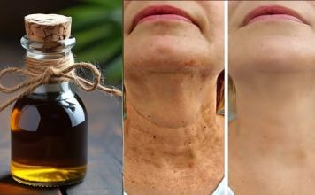 Čarobno ulje protiv starenja, ☘️ Zaglađuje sve bore na licu snažnije od botoksa