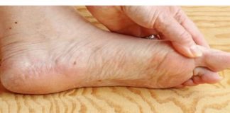 7 znakova da se tijelo već duže vrijeme bori s VISOKIM ŠEĆEROM UKRVI: Prvo ćete to primijetiti na očima i nogama!