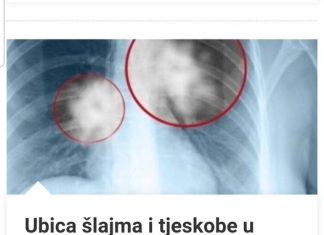Ubica Šlajma I Tjeskobe U Grudima: Smjesa Od TRI Sastojka Liječi Vaša PLUĆA I Disajne Puteve