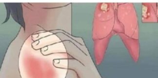 EVO KAKO MOŽETE PROVJERITI DA LI IMATE SLAB IMUNITET: 6 Znakova Lošeg Imuniteta, Ovako Tijelo Upozorava