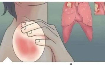 EVO KAKO MOŽETE PROVJERITI DA LI IMATE SLAB IMUNITET: 6 Znakova Lošeg Imuniteta, Ovako Tijelo Upozorava