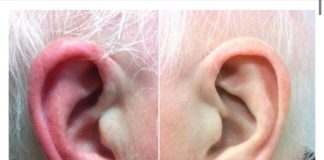 UŠI VAM SE ZACRVENE I OSJEĆATE KAO DA GORE: