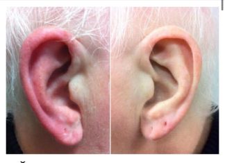 UŠI VAM SE ZACRVENE I OSJEĆATE KAO DA GORE: