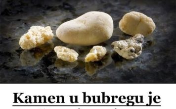 KAMEN U BUBREGU BIT ĆE PROŠLOST..ISTOPITE GA POMOĆU OVOG DOMAĆEG LIJEKA
