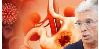 Saša Popović je patio od ove bolesti: Prvi simptom se javlja prilikom jela, a mnogi ga zanemaruju