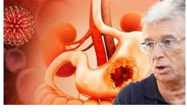 Saša Popović je patio od ove bolesti: Prvi simptom se javlja prilikom jela, a mnogi ga zanemaruju