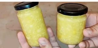 Loš holesterol kao da ga nikad nije bilo: PRIRODNI LIJEK ZA ČIŠĆENJE KRVNIH ŽILA!