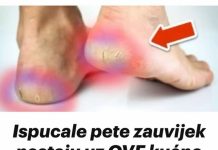 Ispucale pete zauvijek nestaju uz OVE kućne lijekove💥(Super lako)🤯