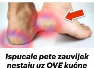 Ispucale pete zauvijek nestaju uz OVE kućne lijekove💥(Super lako)🤯