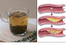 Borite se protiv bolesti kao što su loša cirkulacija, masna jetra, hipertenzija i …