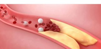 Jednu namirnicu opće ne jedemo, a nismo ni svjesni koliko je dobra