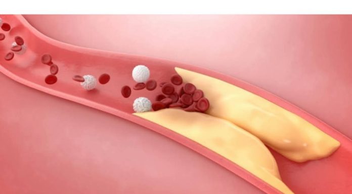 Jednu namirnicu opće ne jedemo, a nismo ni svjesni koliko je dobra