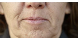 Simptom DEMENCIJE koji se javlja u ustima: Ako ga osjetite, obratite se ljekaru!