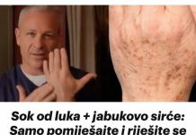 Sok od luka + jabukovo sirće: Samo pomiješajte i riješite se staračkih pjega na rukama, licu i dekolteu jednom za svagda!