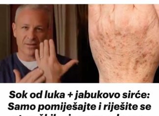 Sok od luka + jabukovo sirće: Samo pomiješajte i riješite se staračkih pjega na rukama, licu i dekolteu jednom za svagda!