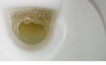 Vidite li mjehuriće u urinu? To može ukazivati na ozbiljnije zdravstveno stanje!