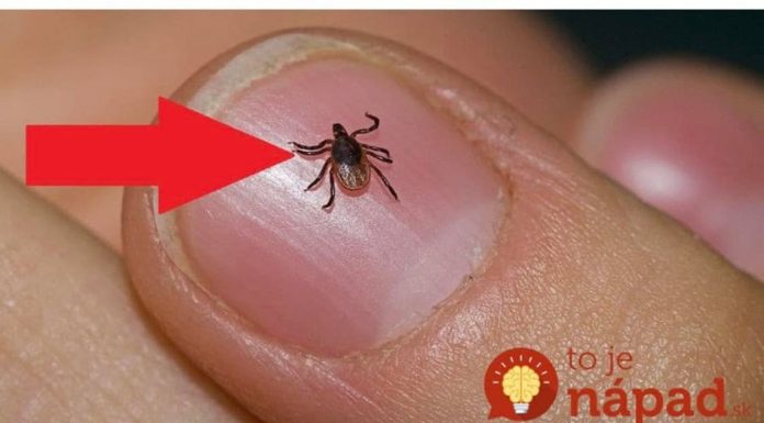 Spas od krpelja: Samo uradite ovo i NEĆE dirati ni vas ni vašeg psa + savjet kako da ih izbacite iz vašeg dvorišta!