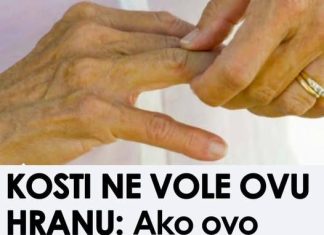 Ova hrana je štetna za zdravlje kostiju; Konzumacija može pogoršati bol, ubrzati napredovanje artritisa i dovesti do daljnjeg propadanja zglobova.