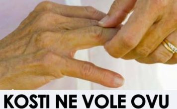 Ova hrana je štetna za zdravlje kostiju; Konzumacija može pogoršati bol, ubrzati napredovanje artritisa i dovesti do daljnjeg propadanja zglobova.