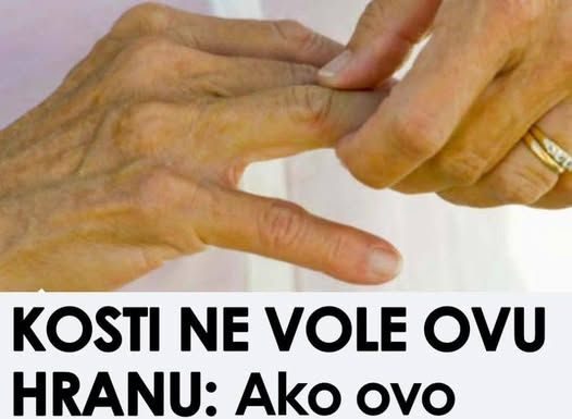 Ova hrana je štetna za zdravlje kostiju; Konzumacija može pogoršati bol, ubrzati napredovanje artritisa i dovesti do daljnjeg propadanja zglobova.