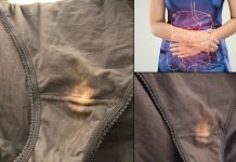 Imate li problema sa ovim mrljama?