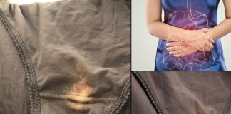 Imate li problema sa ovim mrljama?