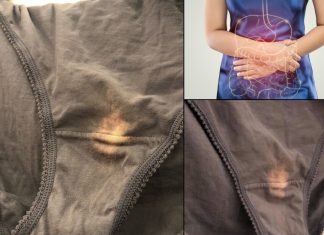 Imate li problema sa ovim mrljama?