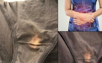 Imate li problema sa ovim mrljama?