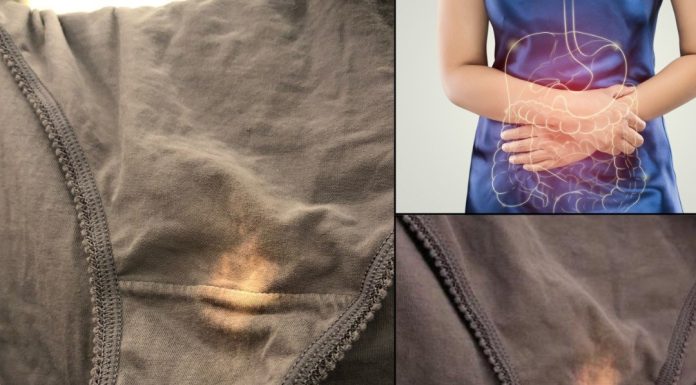 Imate li problema sa ovim mrljama?