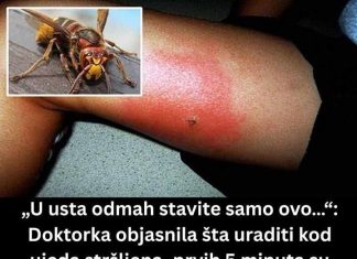 UJEO VAS JE STRŠLJEN? EVO ŠTA ODMAH URADITI! 🐝