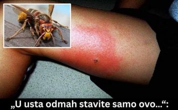 UJEO VAS JE STRŠLJEN? EVO ŠTA ODMAH URADITI! 🐝