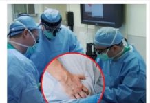 MOŽE LI RAK PANKREASA DA SE SPRIJEČI: Zašto se ovaj karcinom tako teško otkriva i kosi ljude tom brzinom?