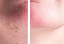 DLAČICE S LICA nestaju kao rukom odnesene Sve žene širom svijeta potpuno su poludile za ovim receptom!