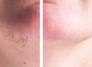 DLAČICE S LICA nestaju kao rukom odnesene Sve žene širom svijeta potpuno su poludile za ovim receptom!